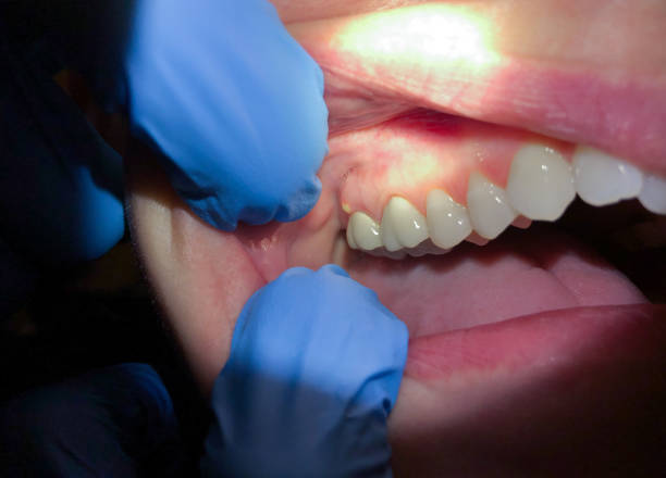 Best Tooth Pain Emergency Relief  in Winston, OR