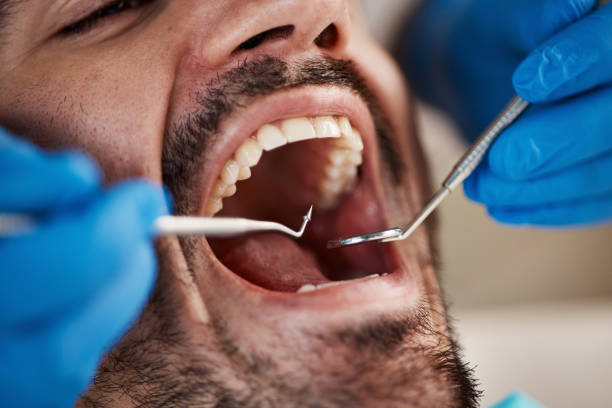 Best Dentist for Tooth Abscess  in Winston, OR